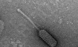 Entc-S90-Entc10-C__08_Mag-150kx Fag Entc_S90